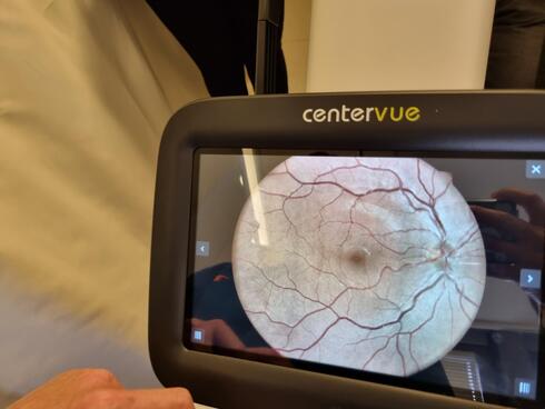 סקר עיניים חדשני לחולי סוכרת